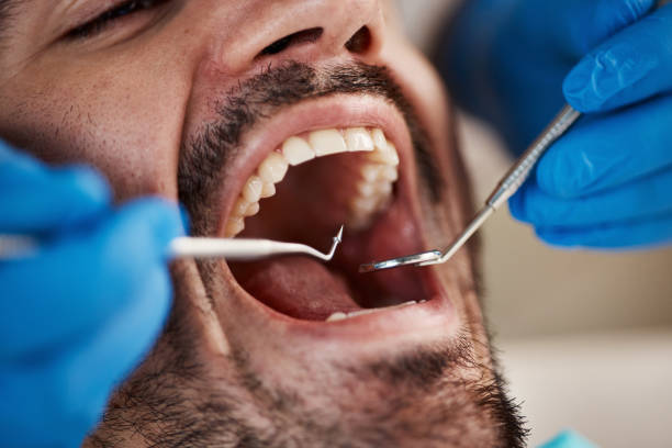 Best Emergency Treatment for Oral Infections in Babbitt, MN